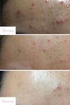 Some By Mi Aha Bha Pha 30 Days Miracle Serum (KORENDY) Yatıştırıcı Aydınlatıcı Serum 50 ml