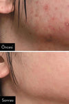Some By Mi Arındırıcı Tonik Aha Bha Pha 30 Days Miracle Toner 150 ml
