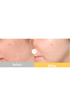 Medicube Kojic Acid Turmeric Brightening Gel Mask