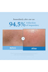 medicube Zero Pore Blackhead Deep Cleansing Oil (Siyah Nokta Giderici Derin Temizleyici Yağ) (GLOBA
