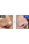 Medicube One Day Exosome Shot Pore Ampoule 2000