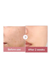 Medicube PDRN Pink Collagen Exosome Shot Serum 7500