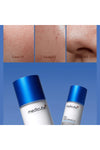 Medicube Zero Pore Serum (Gözenek Karşıtı Serum)