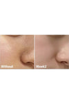 Medicube Zero Pore Toner (Gözenek Karşıtı Tonik)
